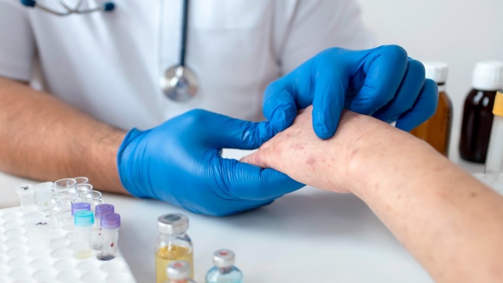Dermatology